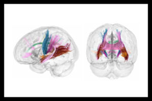 ¿Cómo cambia el cerebro en el embarazo? Un estudio revela nuevas claves