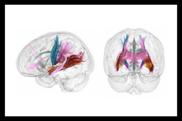 ¿Cómo cambia el cerebro en el embarazo? Un estudio revela nuevas claves